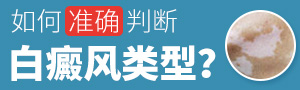 臺州治白癜風(fēng)專科醫(yī)院