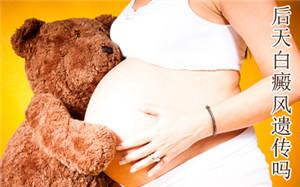 孕婦白癜風(fēng)病會(huì)遺傳嗎？