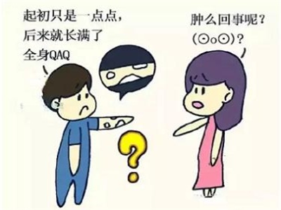 兒童白癜風(fēng)