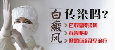 白癜風(fēng)會傳染嗎？