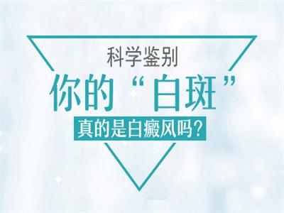 白癜風(fēng)白斑的顏色有哪些？