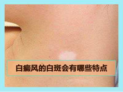 早期白癜風(fēng)患者的皮膚有哪些表現(xiàn)癥狀？