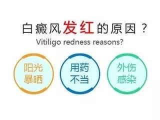 白斑病發(fā)部位發(fā)紅是怎么回事？