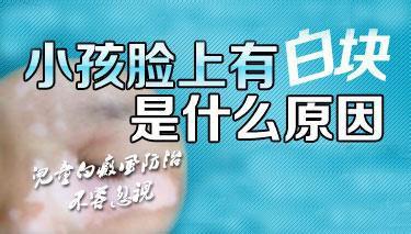 兒童怎樣確診白癜風呢？怎樣診療呢？