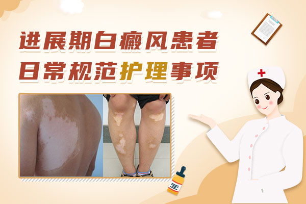 杭州華研白癜風(fēng)醫(yī)院能住院?jiǎn)?白癜風(fēng)患者如何減輕壓力呢