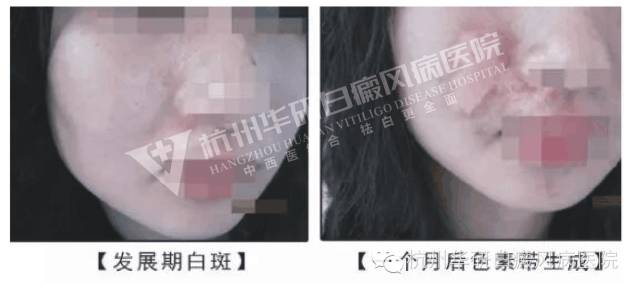 杭州一妙齡女子被全村嘲笑,再次出現(xiàn)時全村驚呆了……
