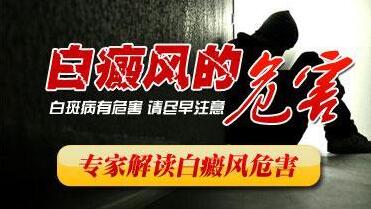 節(jié)段型白癜風(fēng)對(duì)人有什么影響