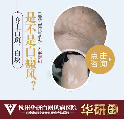 白斑患者在飲食方面的需要注意的事項(xiàng)