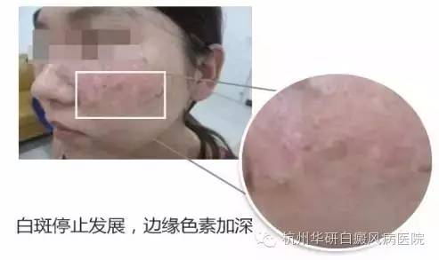 杭州一妙齡女子被全村嘲笑,再次出現(xiàn)時全村驚呆了……