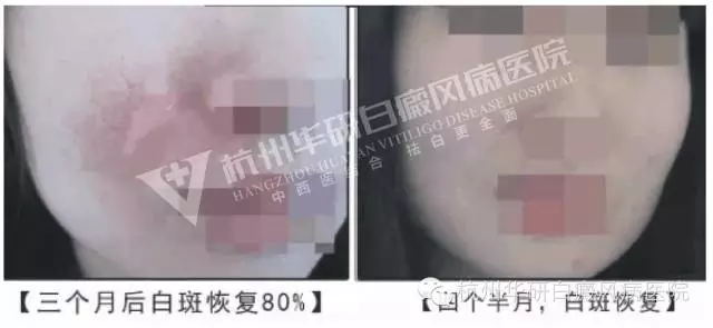 杭州一妙齡女子被全村嘲笑,再次出現(xiàn)時全村驚呆了……